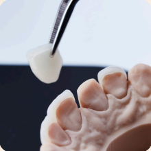 Veneer Indirect